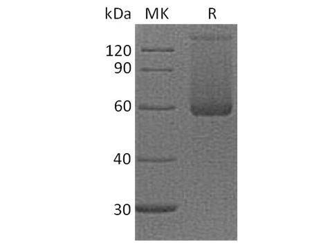 Recombinant Cynomolgus LAG-3/CD223 Protein (His Tag) - ABMIUM