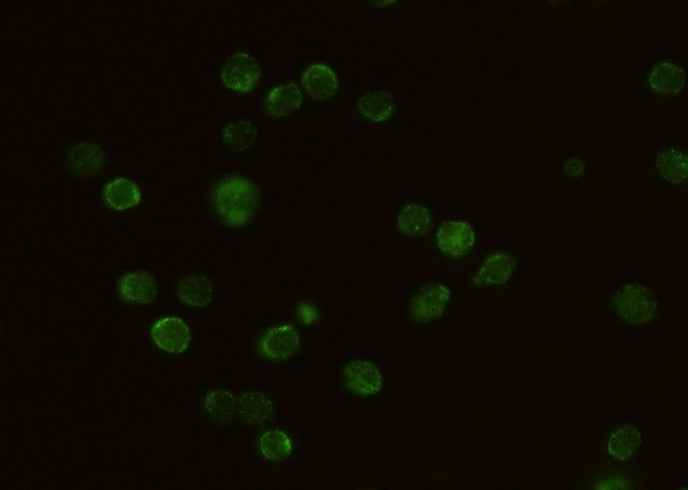 Anti-Mouse IL2RG Antibody [B403] - ABMIUM