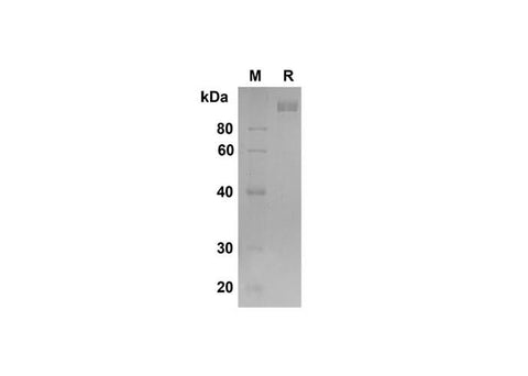 SDS-PAGE analysis of Mouse DPPIV/CD26 proteins , 2 μg/lane of Recombinant Mouse DPPIV/CD26 proteins was resolved with SDS-PAGE under reducing conditions , showing bands at 105 kDa.