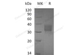 Recombinant Mouse CD32b/FCGR2B Protein (His Tag) - ABMIUM