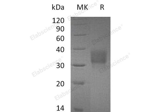 Recombinant Mouse CD32b/FCGR2B Protein (His Tag) - ABMIUM