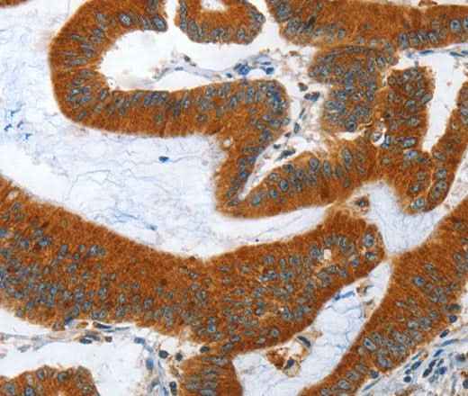 Anti-Human/Mouse ANAPC10 Antibody
