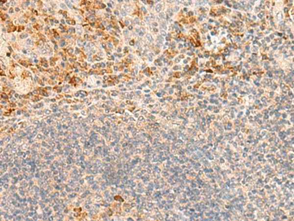 Immunohistochemistry of paraffin-embedded Human tonsil tissue using GRM2 Polyclonal Antibody at dilution of 1:35(×200)