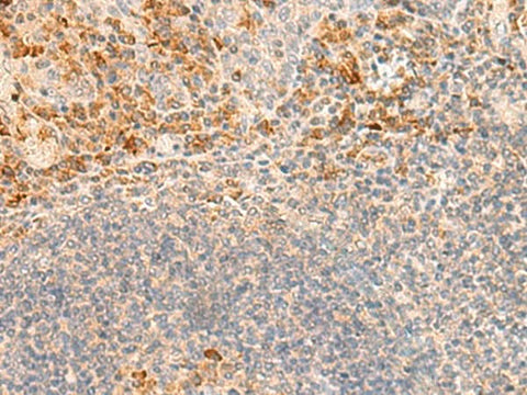 Immunohistochemistry of paraffin-embedded Human tonsil tissue using GRM2 Polyclonal Antibody at dilution of 1:35(×200)