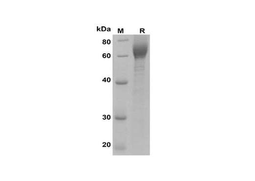 SDS-PAGE analysis of Human ILT6/LILRA3 proteins, 2 μg/lane of Recombinant Human ILT6/LILRA3 proteins was resolved with SDS-PAGE under reducing conditions, showing bands at 60-65 kDa.