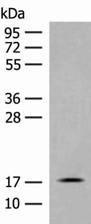 Anti-Human/Mouse/Rat RPS25 Antibody