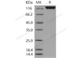 > 98 % as determined by reducing SDS-PAGE.