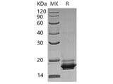 Recombinant Human GGACT Protein (His Tag) - ABMIUM