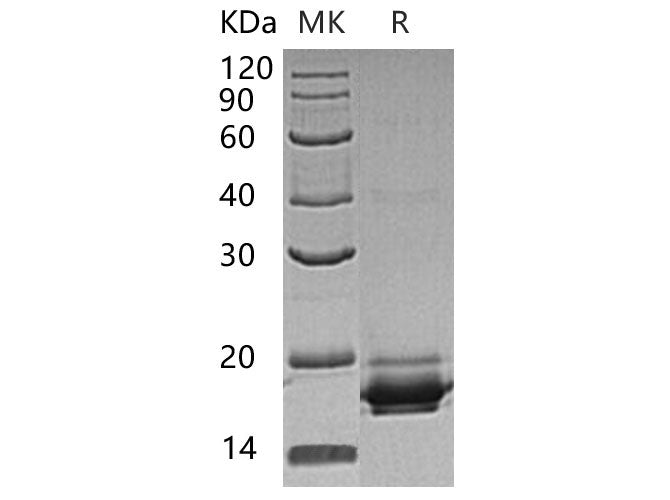 Recombinant Human GGACT Protein (His Tag) - ABMIUM