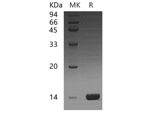 Recombinant Human CCL16 Protein - ABMIUM