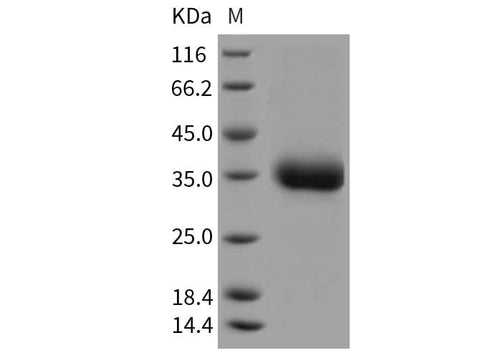 Recombinant Rat Layilin/LAYN Protein (His Tag) - ABMIUM
