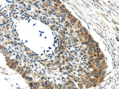 Anti-Human/Mouse/Rat GRIN2A Antibody - ABMIUM