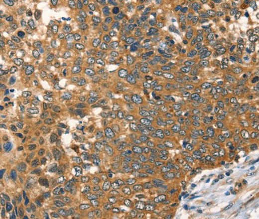 Anti-Human/Mouse AGO1 Antibody - ABMIUM