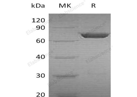 Recombinant Human PGM2 Protein (His Tag) - ABMIUM