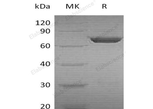 Recombinant Human PGM2 Protein (His Tag) - ABMIUM