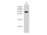 Western Blot analysis of Raji cell using CD74 Polyclonal Antibody at dilution of 1:1000