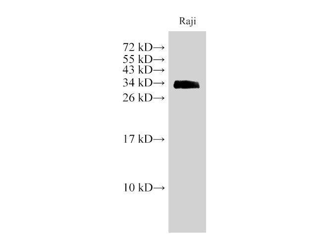 Western Blot analysis of Raji cell using CD74 Polyclonal Antibody at dilution of 1:1000