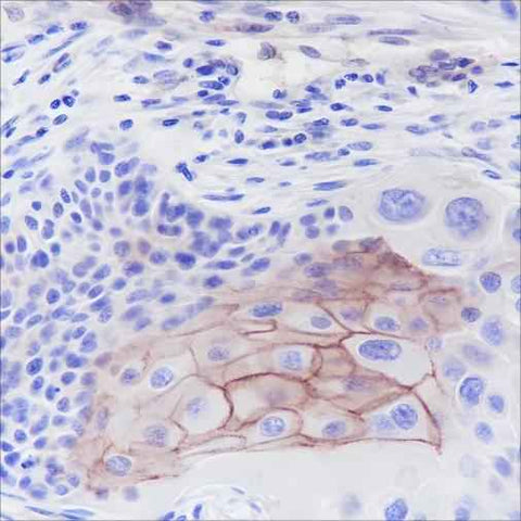 Anti-Human Thrombomodulin Antibody [A376] - ABMIUM