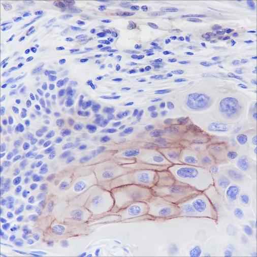 Anti-Human Thrombomodulin Antibody [A376] - ABMIUM