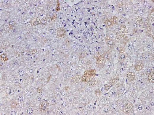 Anti-Human ALB Antibody - ABMIUM