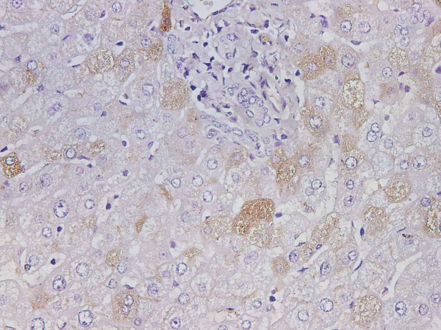 Anti-Human ALB Antibody - ABMIUM