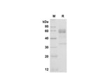 SDS-PAGE analysis of Human Folate Binding protein/FBP proteins, 2 μg/lane of Recombinant Human Folate Binding protein/FBP proteins was resolved with SDS-PAGE under reducing conditions, showing bands at 47.9 kDa.