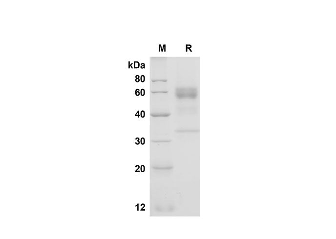 SDS-PAGE analysis of Human Folate Binding protein/FBP proteins, 2 μg/lane of Recombinant Human Folate Binding protein/FBP proteins was resolved with SDS-PAGE under reducing conditions, showing bands at 47.9 kDa.