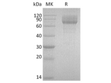 Recombinant Human IL-22BP/IL-22RA2 Protein (Fc Tag) - ABMIUM