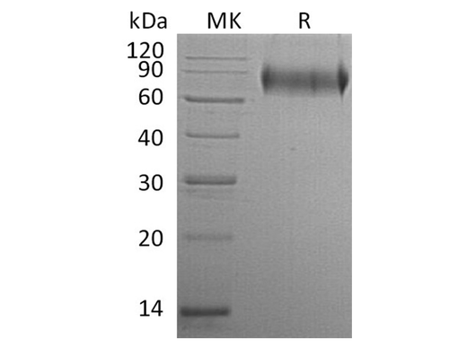 Recombinant Human E-Selectin/SELE Protein (His Tag) - ABMIUM