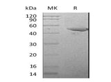Recombinant Mouse Serpin E1/PAI-1 Protein (His Tag) - ABMIUM