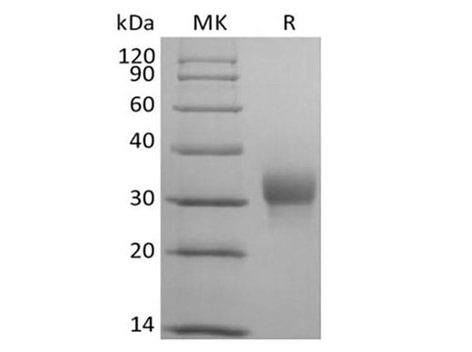Recombinant Human Leukocyte-associated Immunoglobulin-like Receptor 1/LAIR1/CD305 (C-Avi-6His) Biotinylated - ABMIUM