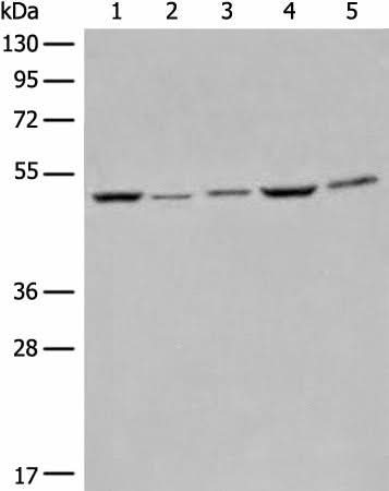 Western blot analysis of Raji Hela A549 HEPG2 and 231 cell lysates using EIF4A3 Polyclonal Antibody at dilution of 1:500