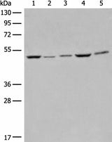Western blot analysis of Raji Hela A549 HEPG2 and 231 cell lysates using EIF4A3 Polyclonal Antibody at dilution of 1:500