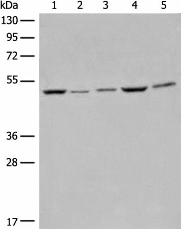 Western blot analysis of Raji Hela A549 HEPG2 and 231 cell lysates using EIF4A3 Polyclonal Antibody at dilution of 1:500