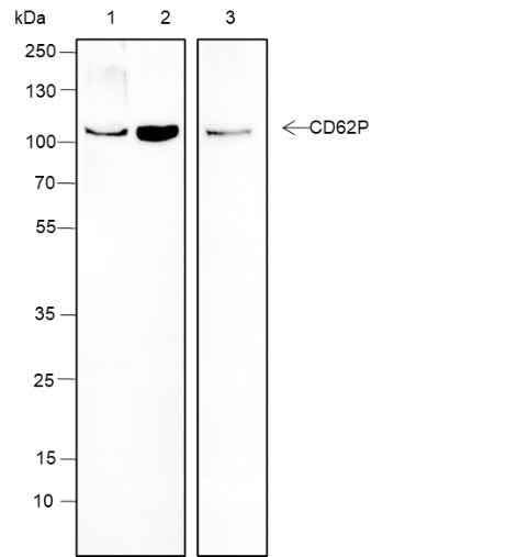 Anti-Human/Mouse CD62P Antibody [A180] - ABMIUM