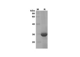 SDS-PAGE analysis of Mouse CXCL7 proteins, 2 μg/lane of Recombinant Mouse CXCL7 proteins was resolved with SDS-PAGE under reducing conditions, showing bands at 30 kDa.