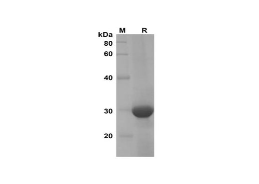 SDS-PAGE analysis of Mouse CXCL7 proteins, 2 μg/lane of Recombinant Mouse CXCL7 proteins was resolved with SDS-PAGE under reducing conditions, showing bands at 30 kDa.