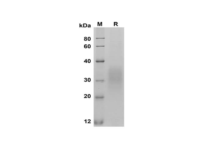SDS-PAGE analysis of Mouse Fas/TNFRSF6/CD95 proteins, 2 μg/lane of Recombinant Mouse Fas/TNFRSF6/CD95 proteins was resolved with SDS-PAGE under reducing conditions, showing bands at 30-35 kDa.