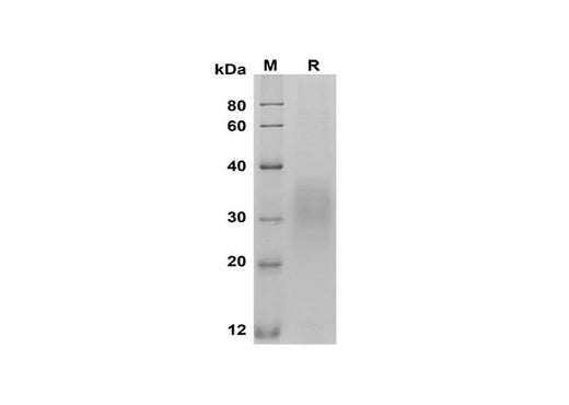 SDS-PAGE analysis of Mouse Fas/TNFRSF6/CD95 proteins, 2 μg/lane of Recombinant Mouse Fas/TNFRSF6/CD95 proteins was resolved with SDS-PAGE under reducing conditions, showing bands at 30-35 kDa.