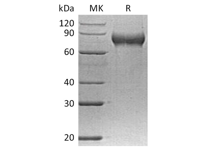 Recombinant Human FLRT2 Protein (His Tag) - ABMIUM