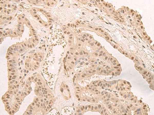 Anti-Human/Mouse/Rat CNOT10 Antibody