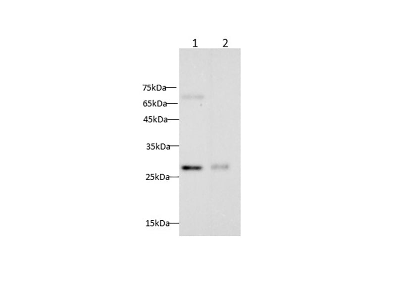 Anti-Mouse/Rat CXCL16 Antibody - ABMIUM