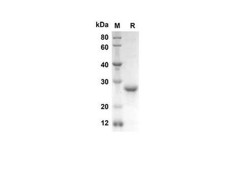 SDS-PAGE analysis of Human ECF/CCL11 proteins, 2 μg/lane of Recombinant Human ECF/CCL11 proteins was resolved with SDS-PAGE under reducing conditions, showing bands at 24.1 kDa.