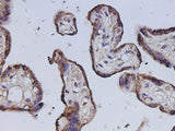 Anti-Human Gh1 Antibody - ABMIUM