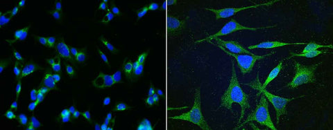 Anti-Human APOH Antibody [A1061] - ABMIUM