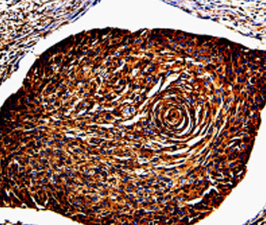 Anti-Human/Mouse ANXA7 Antibody - ABMIUM