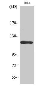 Western Blot analysis of Hela cells using HK1 Polyclonal Antibody at dilution of 1:1000.