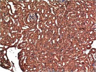 Anti-Human/Mouse/Rat BAX Antibody [1C1]