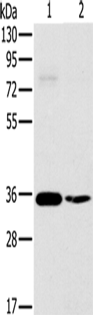 Anti-Human/Mouse/Rat OTUB1 Antibody - ABMIUM