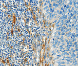 Anti-Human/Mouse/Rat DIO2 Antibody - ABMIUM